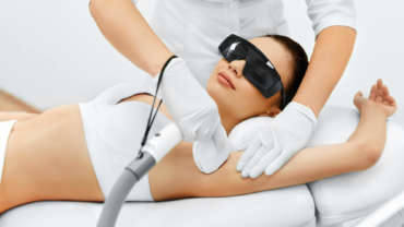 Laser Hair Removal