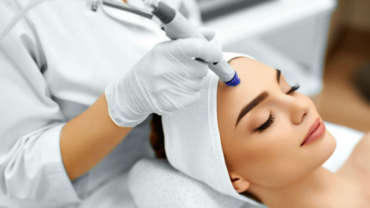 Microdermabrasion