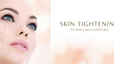 Skin Tightening